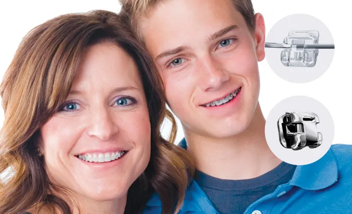 Madre e hijo sonriendo, el adolescente con brackets de autoligado del sistema Damon